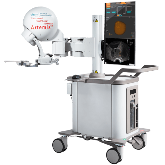 System zur Fusionsbiopsie der Prostata_Urologie_Amriswil