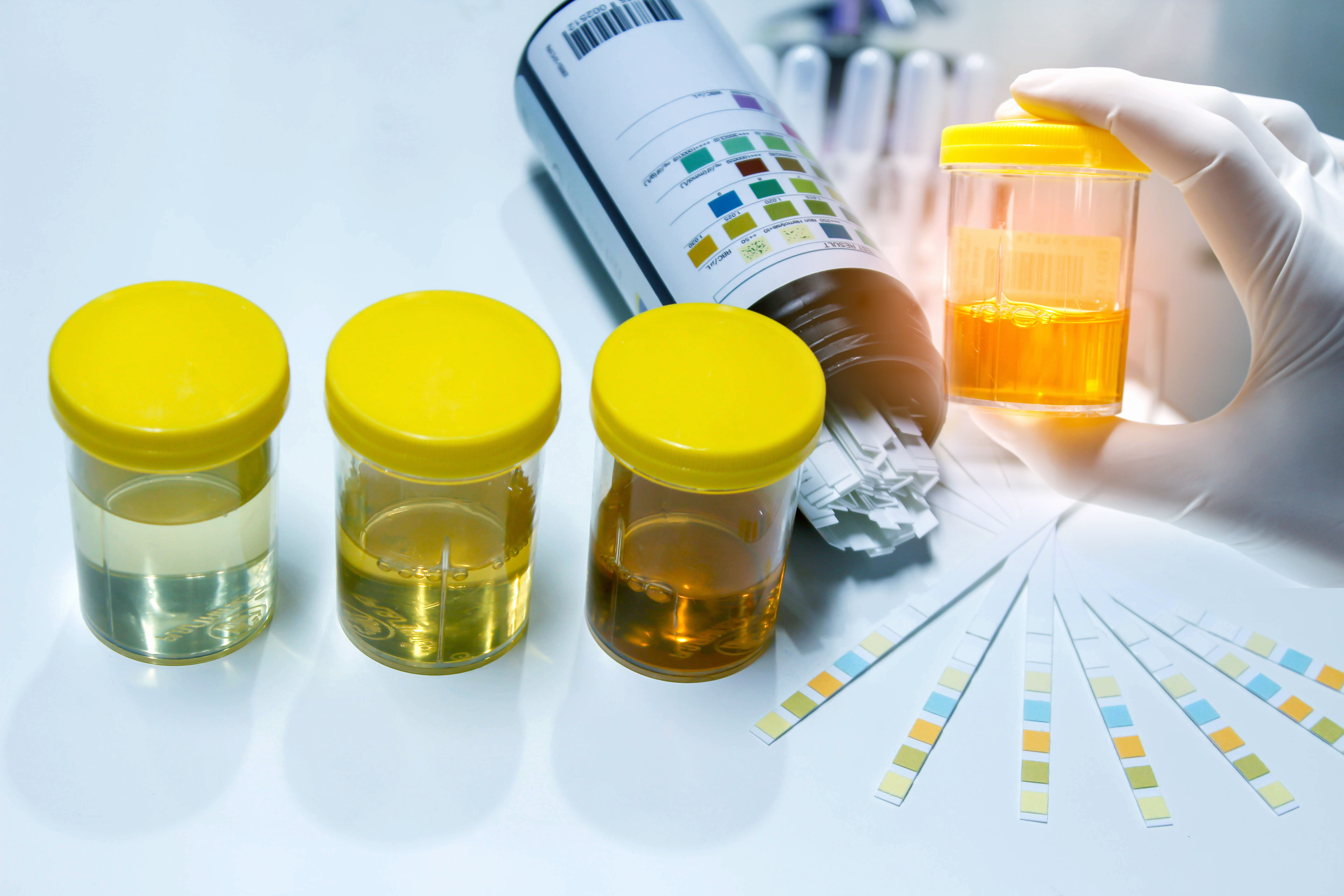Urinanalyse_Urologie_Anmriswil